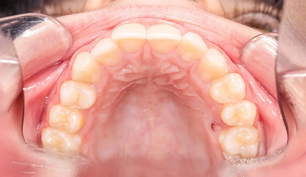 Teeth